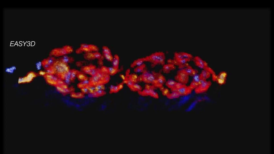 3D super-resolution volume image of active zones at the Drosophila larval neuromuscular junction